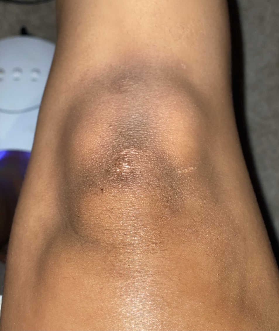 throwbacklorde's tweet image. That black girl kneeee