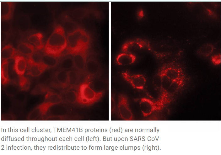 12. Scientists map the network of SARS-CoV-2’s helpers inside human cells https://www.rockefeller.edu/news/29727-scientists-map-network-sars-cov-2s-helpers-inside-human-cells/