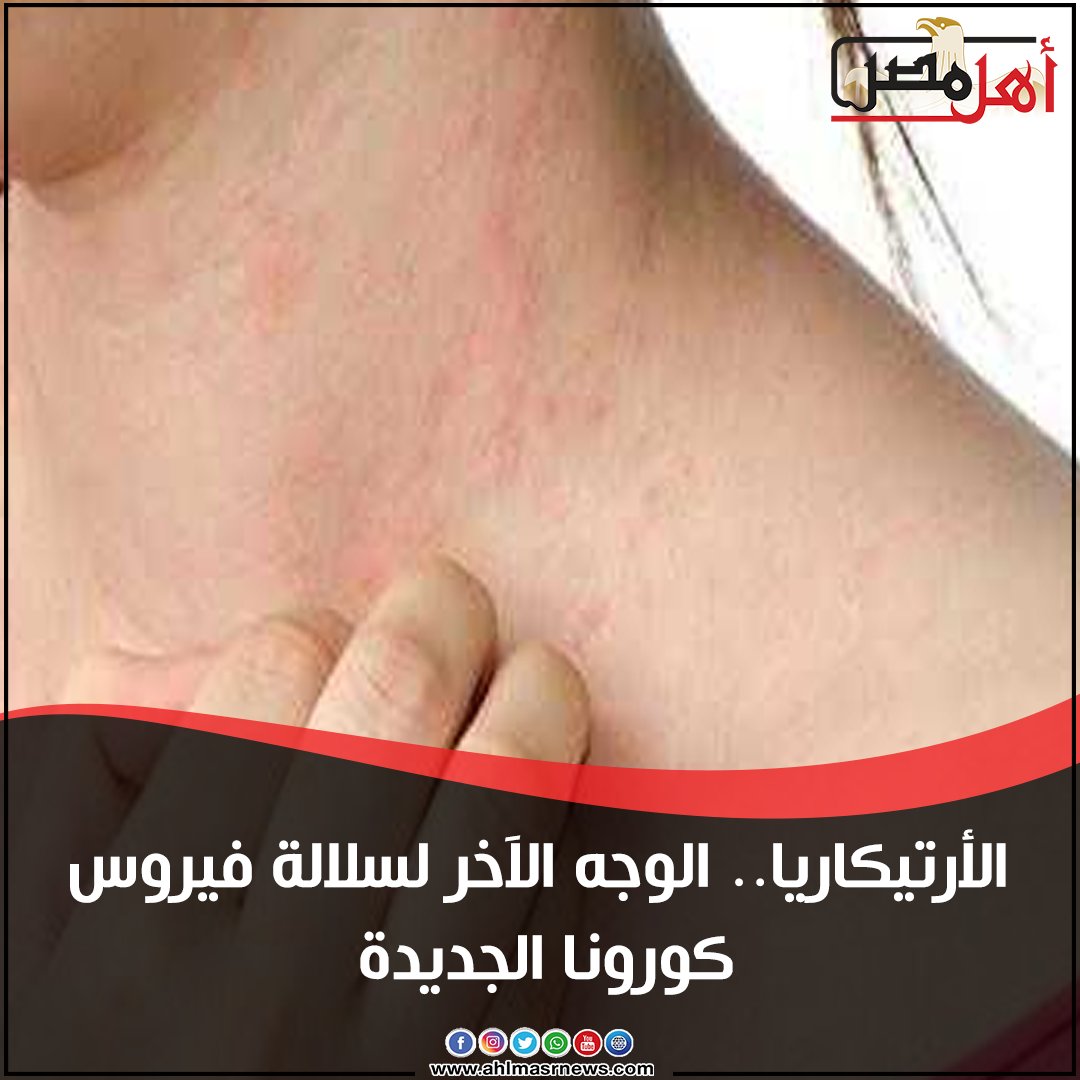 تصحيح التشجيع الاشتراكي مرض الارتكاريا الجلدي Guillotinpoilvet Com