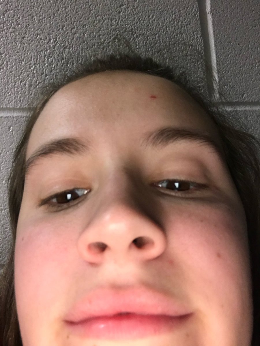 NourseSam's tweet photo. The picture a kid takes on their iPad https://t.co/ANkzPOYbUj