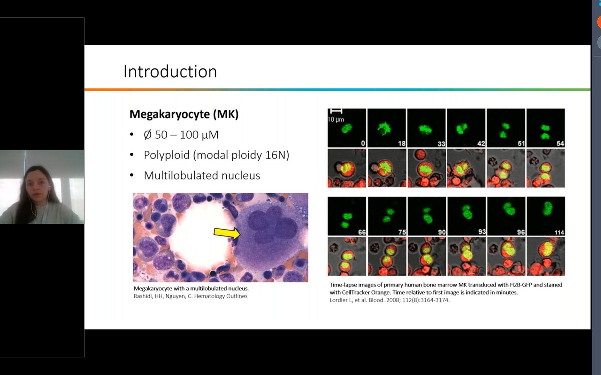 Proteoblood (@proteoblood) on Twitter photo 🏆Congratulations to <a href="/miranda_f_s/">Miranda Fernández-Serrano</a> PhD fellow from <a href="/roue_s/">Roué Lab</a> for her wonderful presentation on genomic characterization of micromegakaryocytes in myelodysplastic syndromes🔬. Her talk was part of the Young Researcher seminar series hosted by <a href="/CarrerasIJC/">Josep Carreras Leukaemia Research Institute (IJC)</a>. Congrats Miranda 🎉👏!!! 🏆Congratulations to <a href="/miranda_f_s/">Miranda Fernández-Serrano</a> PhD fellow from <a href="/roue_s/">Roué Lab</a> for her wonderful presentation on genomic characterization of micromegakaryocytes in myelodysplastic syndromes🔬. Her talk was part of the Young Researcher seminar series hosted by <a href="/CarrerasIJC/">Josep Carreras Leukaemia Research Institute (IJC)</a>. Congrats Miranda 🎉👏!!!