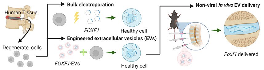 NinaSTang's tweet photo. Check out our newest publication in @eCM_Journal highlighting #engineered #extracellularvesicles for non-viral delivery of developmental transcription factor #FOXF1 to the IVD in-vitro and in-vivo. 

https://t.co/Ex11nfdLMa https://t.co/4PvHFOKRDS