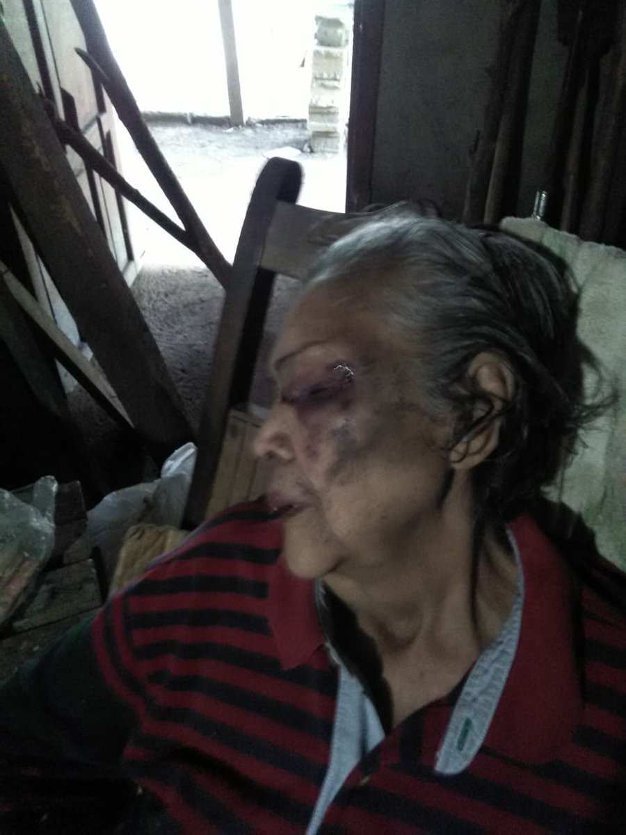 jiminfoolish's tweet photo. nunca habia hecho esto en mi vida pero hay una primera vez para todo.

RT POR FAVOR 😢 @BTS_twt

mi abuelita el día de ayer se cayo en el baño, se golpeo todo el cuerpo y llamamos al doctor para que le diera asistencia medica, se puso realmente mal, incluso nos dijo de que + https://t.co/2vCbAr7Qfv