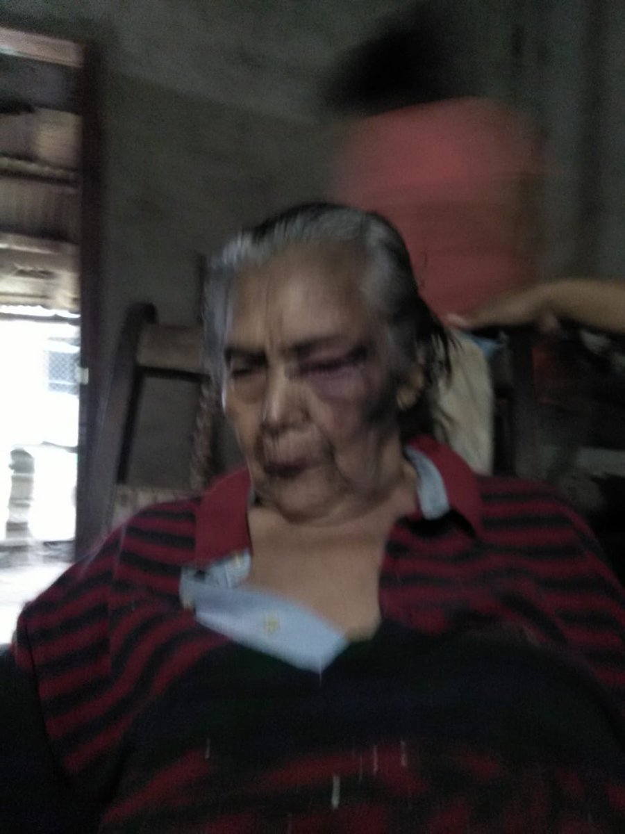 jiminfoolish's tweet photo. nunca habia hecho esto en mi vida pero hay una primera vez para todo.

RT POR FAVOR 😢 @BTS_twt

mi abuelita el día de ayer se cayo en el baño, se golpeo todo el cuerpo y llamamos al doctor para que le diera asistencia medica, se puso realmente mal, incluso nos dijo de que + https://t.co/2vCbAr7Qfv