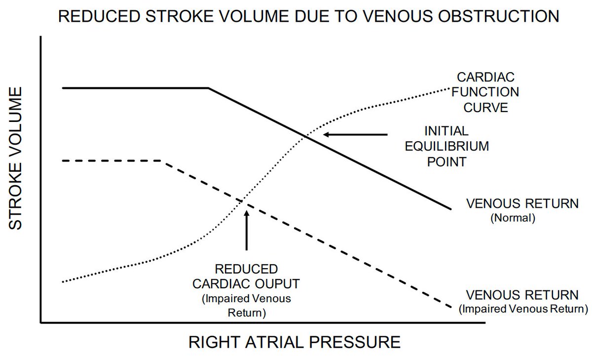 5. Yet, not only conditions with too much preload can cause symptoms of heart failure.Lack of preload augmentation with activity (preload reserve failure) will limit function. This is very likely to be mislabeled as heart failure with normal ejection fraction aka HFpEF