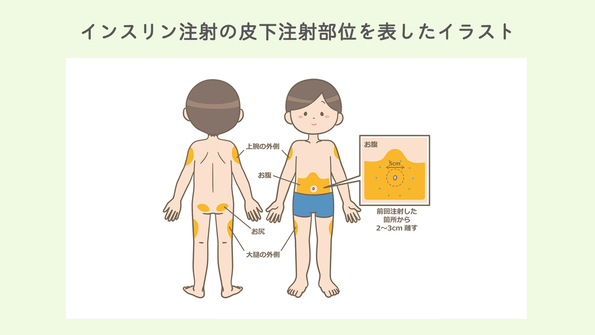 看護師 イラスト集 看護roo 看護師 イラスト集 には1枚で勉強できちゃうイラストがいっぱい ぜひ使ってみてください T Co Uymywkl3bn Instagramでは人気イラストをチェックできます T Co Eezsnrkvur T Co