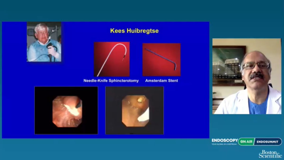 EndoscopyOA's tweet photo. #ENDOSUMMIT2021 just opened with a master lecture "𝟯𝟬 𝘆𝗲𝗮𝗿 𝗼𝗳 𝗘𝗥𝗖𝗣 – 𝘄𝗵𝗮𝘁 𝗰𝗼𝗺𝗲𝘀 𝗻𝗲𝘅𝘁?" with Dr D Nageshwar Reddy who is currently the Chairman of Asian Institute of Gastroenterology and AIG Hospitals, Hyderabad, India. https://t.co/29lQKLcqqZ