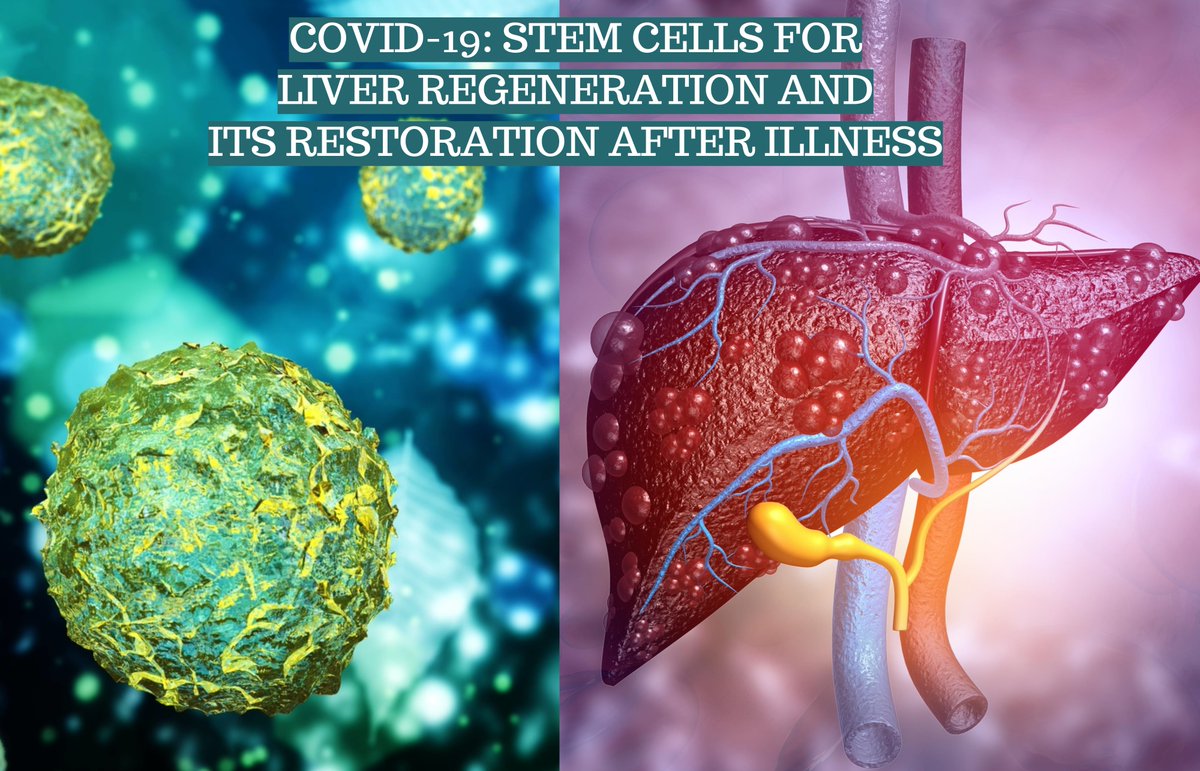 #StemCellTherapy for #liver diseases at UCTC eliminates pathological changes in the body resulting from negative effects of the virus.
Injected stem cells enter the zone of hepatocyte death, form new pools of cells, and restore damaged liver cells.
More at uctclinic.com/covid-19-stem-…