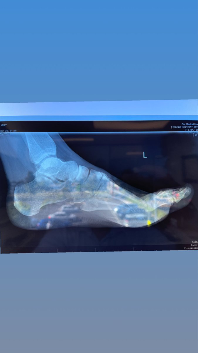 SoleMotionPod's tweet image. Cars in the foot