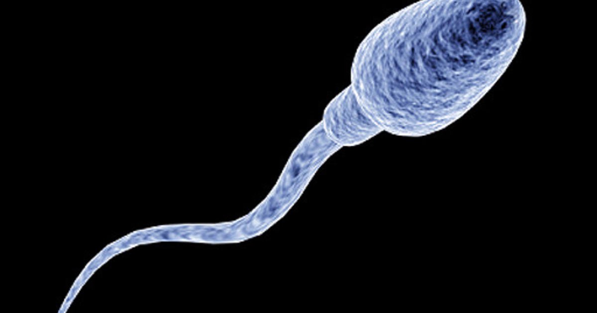 The Relationship between the #Halosperm Assay and #Semen Analysis Performed According to the 4th and the 5th Editions of the #World Health Organization Guidelines, To read complete article please click on the link given: bit.ly/3qDcuyh