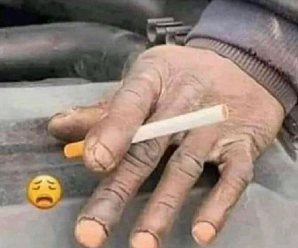CauseWereGuys's tweet photo. If his hands look like this, he's gonna have that car running in 15 minutes https://t.co/slQL1Y0bHN
