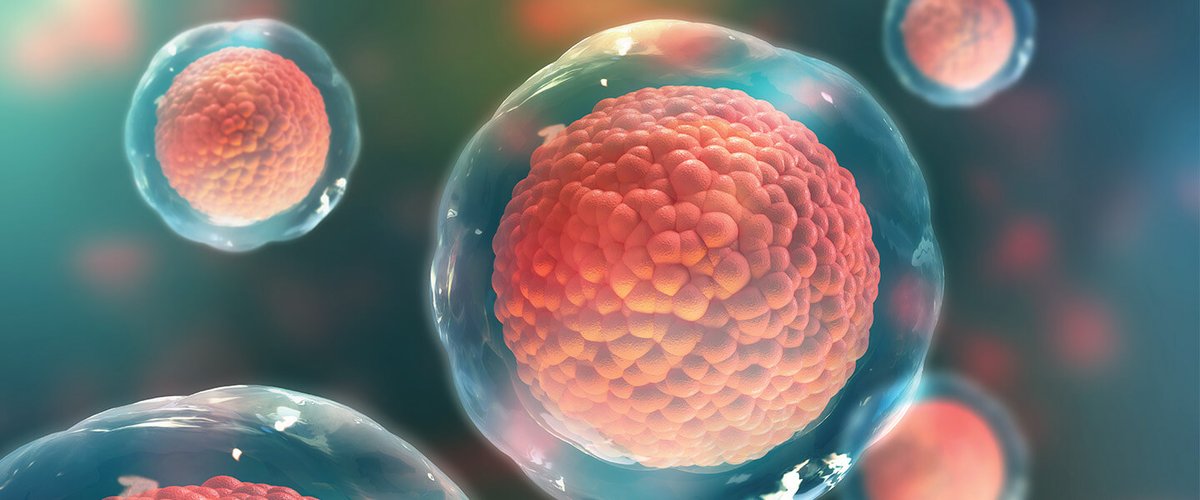 BBRFoundation's tweet photo. How #stem-cell research is providing an unprecedented view of pathology in brain cells caused by #genetic risk factors. https://t.co/6qif85lHMu
#schizophrneia #autism https://t.co/FH4IOgfstG