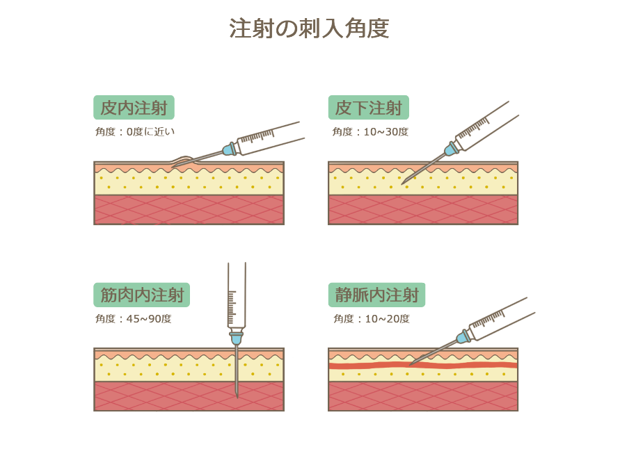 内 注射 静脈 点滴静脈内注射の準備