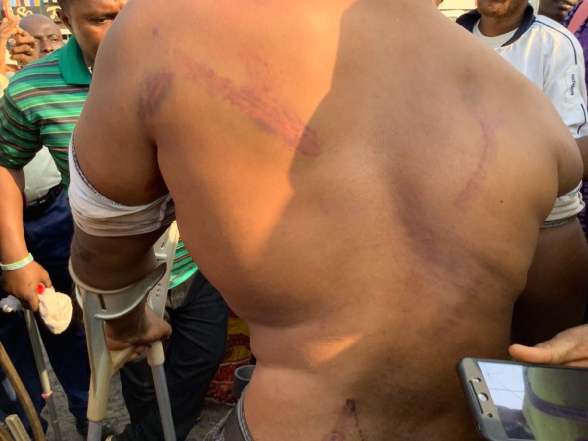 AbsDDumbuya's tweet photo. Police brutality of persons with disabilities in Sierra Leone over illegal grabbing of their land given to them by GoSL. We need justice and we need this ongoing inhumane treatment of PWDs to stop once and for all! https://t.co/cKfE4btbaU