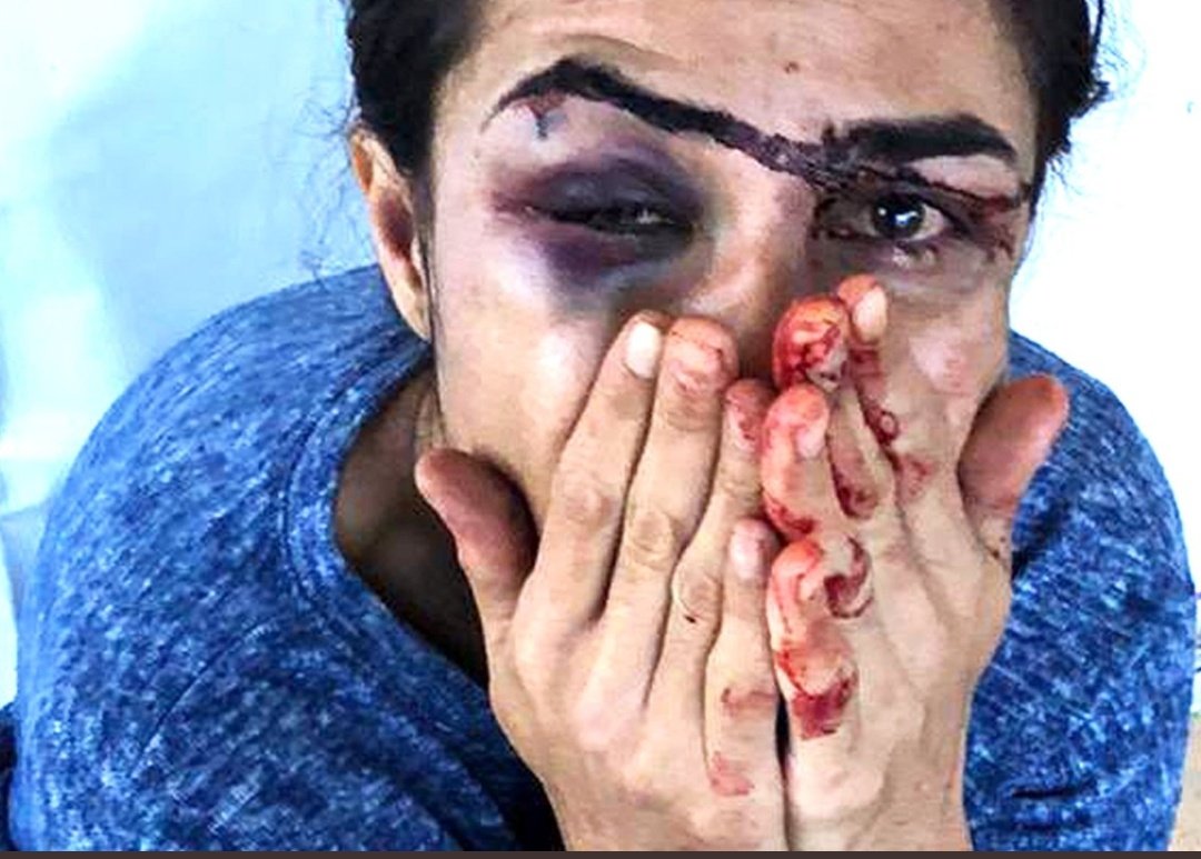 elifsnmz_9's tweet photo. Biri öz yeğenine tecavüz ediyor serbest diğeri bir kadına tecavüz edip intiharına sebep oluyor serbest fakat kadın kendini savununca hemen içeri alıyorsunuz adalet gerçekten bu mu? #SapıkAmcaOsmanıTutukla #Muratktutuklansın https://t.co/OM6UlUAzeZ