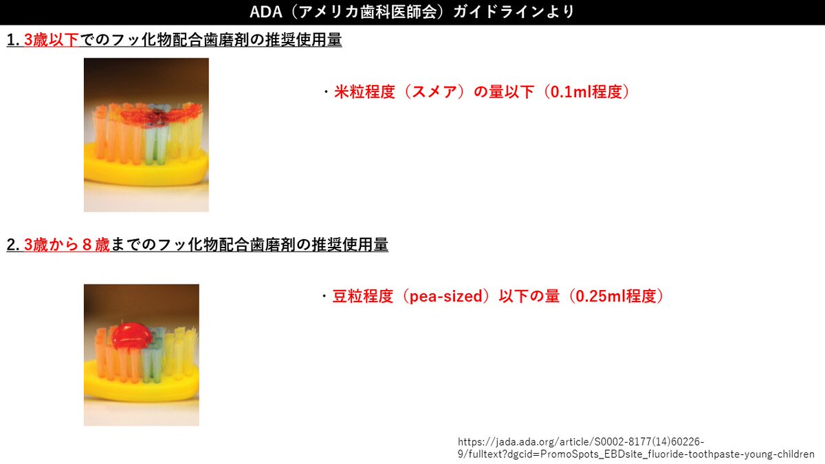 Moody_Dent_Info's tweet photo. 【小児でのフッ化物配合歯磨剤の推奨状況比較】
SIGN（スコットランド）とADA（アメリカ）での、小児でのフッ化物配合歯磨剤の使用量についてまと��てみました。
日本では濃度でも制限する傾向がありますが、このガイドラインではトータルのフッ化物摂取量で制限している傾向が分かります。 https://t.co/GTgs3iU0N4