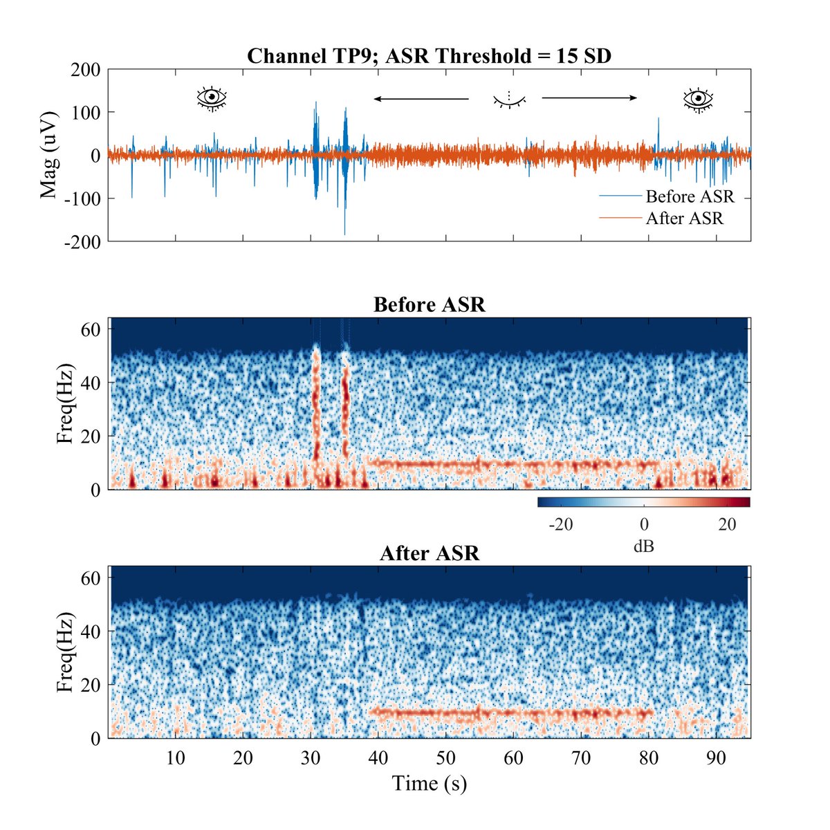 AkshaySujatha's tweet photo. Some thoughts on using ASR after bandpass filtering as a potential good pipeline for a low-density EEG system like Muse (4 ch). Developed for students to quick prototype with Muse for a class I am guest lecturing for

Selecting the right threshold is critical here. 
@AcademicEEG https://t.co/fwuvZw0XuC
