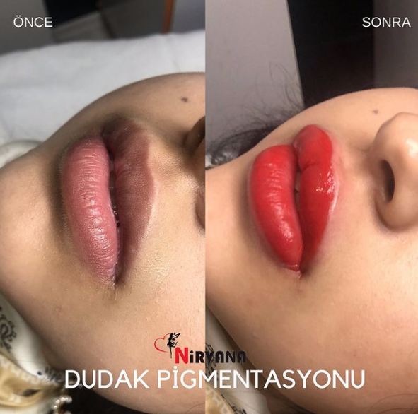 nirvanaestetik's tweet photo. Kalıcı dudak renklendirme işlemi 🥰 Solgun ve renksiz dudaklarınız için ideal işlemdir.🥰 https://t.co/7IVmP2ziel