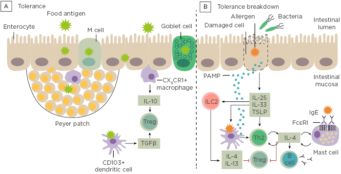 EMJAllergy's tweet image. This article discusses new ways to shape the gut microbiome in cow’s milk protein #allergy. The figure represents the difference between immune tolerance and breakdown of tolerance to ingested antigens. Follow the link to learn more: bit.ly/2PxfDj6