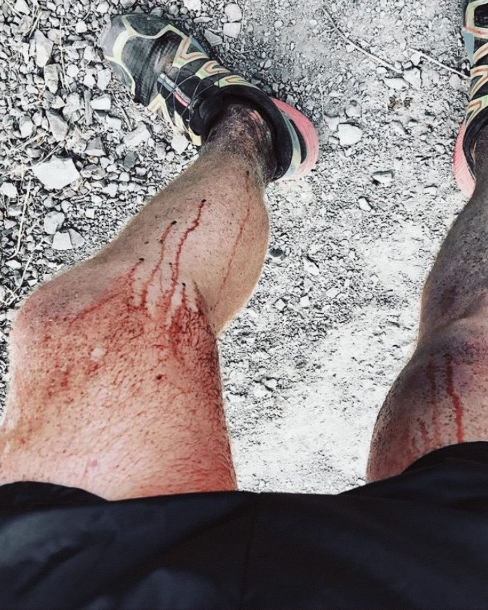 JeffreyBinney's tweet photo. What’s your worst chaffing story?! This one is an oldie but a goodie! circa 2018 🤣 I was talking about this photo in a recent IG Live so I dug it up to reshare. 

#trailrunnerproblems #runnerproblems #ultrarunnerproblems #trailrunning #running #ultrarunning #slowrunnersclub https://t.co/QryZs7oeu4