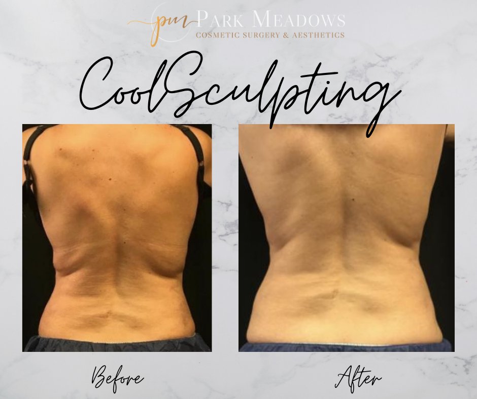 PlasticSurgeryDenver tweet media