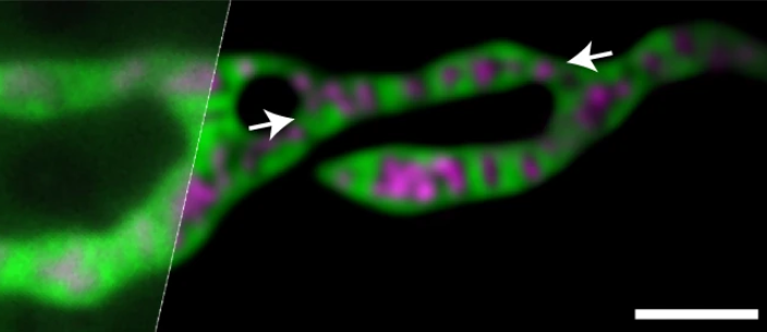 Nature Methods (@naturemethods) on Twitter photo Out today from Dong Li's lab, a deep learning approach that uses frequency content information in the Fourier domain to improve SIM reconstruction under low-SNR conditions. And an accompanying News and Views from <a href="/davephoffman/">David Hoffman</a>! nature.com/articles/s4159… nature.com/articles/s4159… Out today from Dong Li's lab, a deep learning approach that uses frequency content information in the Fourier domain to improve SIM reconstruction under low-SNR conditions. And an accompanying News and Views from <a href="/davephoffman/">David Hoffman</a>! nature.com/articles/s4159… nature.com/articles/s4159…
