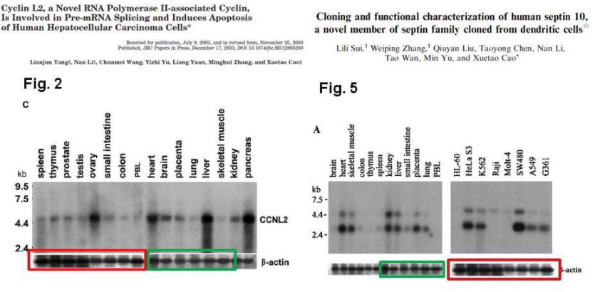 And here, the same blot maybe was accidentally reused in two different papers to represent two different sets of tissues. https://pubpeer.com/publications/2DA67F4FE904F63A1EE6F0550077B6
