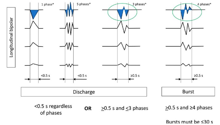 SBeniczky's tweet photo. The new ACNS guideline on cEEG has just been published - now all inclusive: with seizures and status epilepticus too. Lots of useful infographics and examples.
https://t.co/LVkcA8VSCW
#EEG #criticalcare #epilepsy https://t.co/5lQ55HHJNV