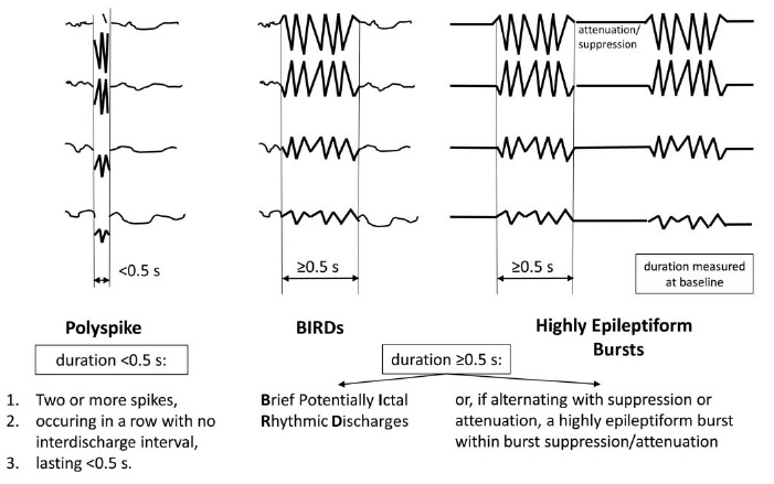 SBeniczky's tweet photo. The new ACNS guideline on cEEG has just been published - now all inclusive: with seizures and status epilepticus too. Lots of useful infographics and examples.
https://t.co/LVkcA8VSCW
#EEG #criticalcare #epilepsy https://t.co/5lQ55HHJNV