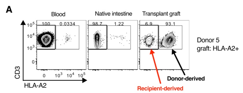 Organ transplantation is now a really exciting context in which to study human Trm cells. Using this technique, we studied human Trm cells in the gut following intestinal transplantation. The technique works really well for some mismatches!
