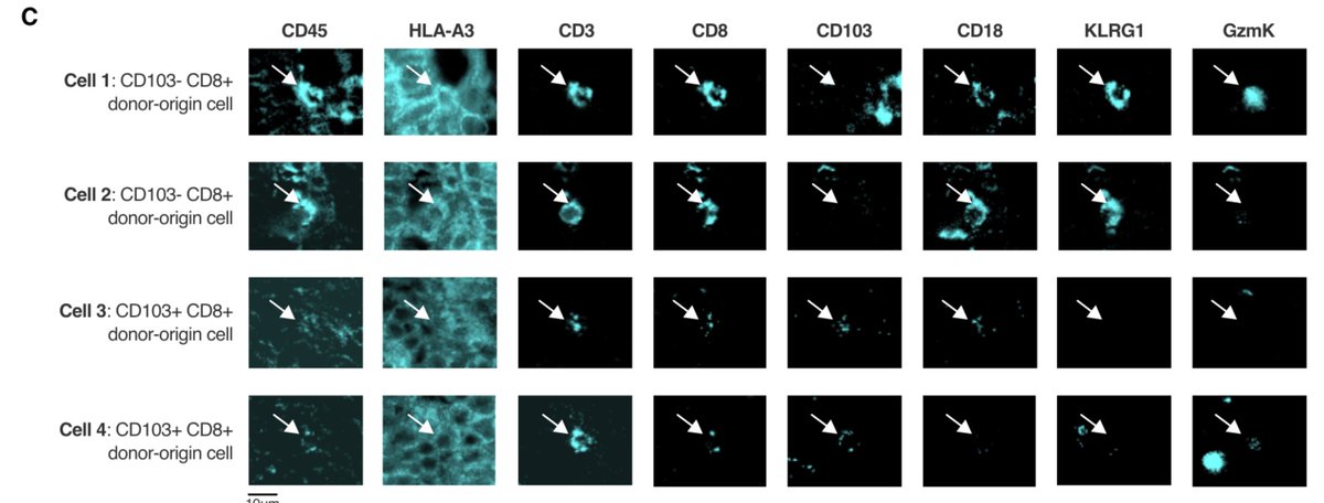 We used flow cytometry, and a cool multiplex imaging technique called chip cytometry, to confirm the presence and phenotypic differences between these two CD8+ Trm cell subsets in both health and intestinal transplantation.