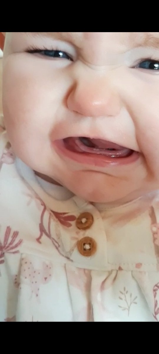 JohnGlynn_'s tweet photo. @MicroGem Toof 🦷 https://t.co/Iz1H4W7KVO