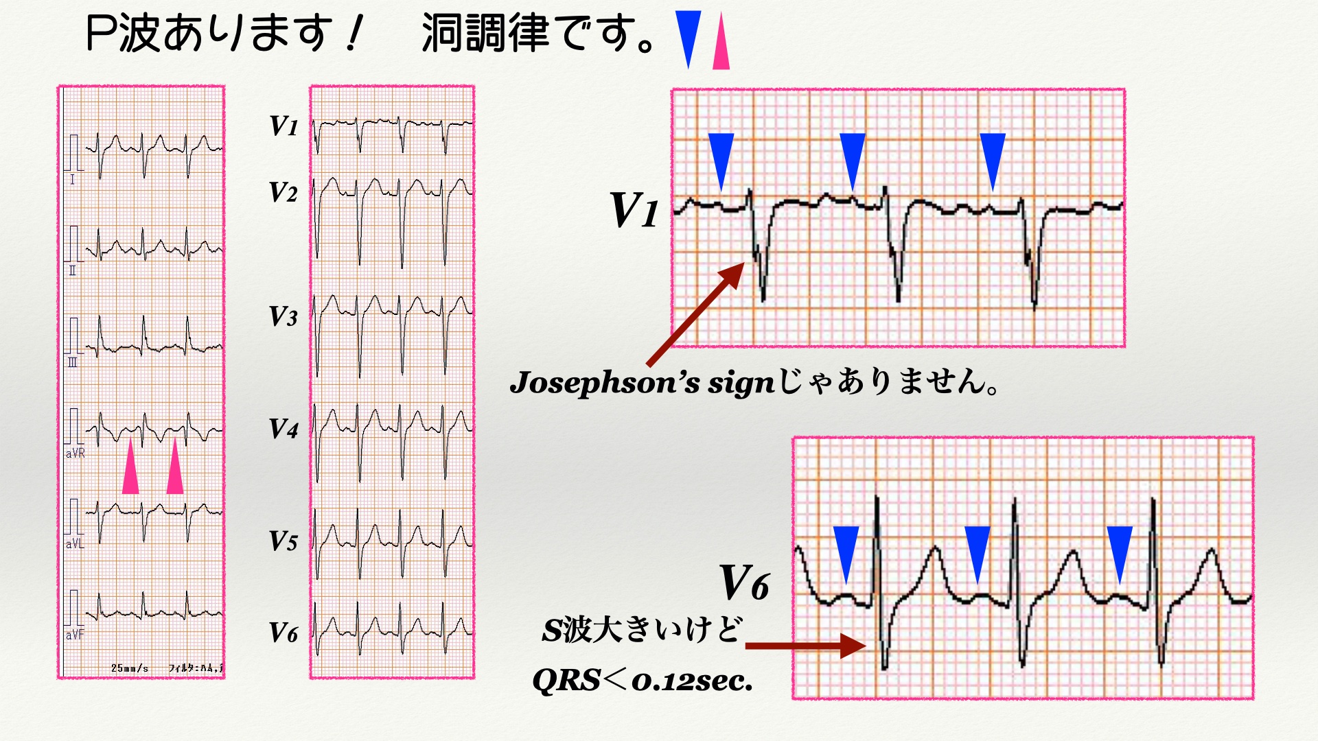 N. Tsukishima EP大学心電図検定学部試験対策科担任 on X