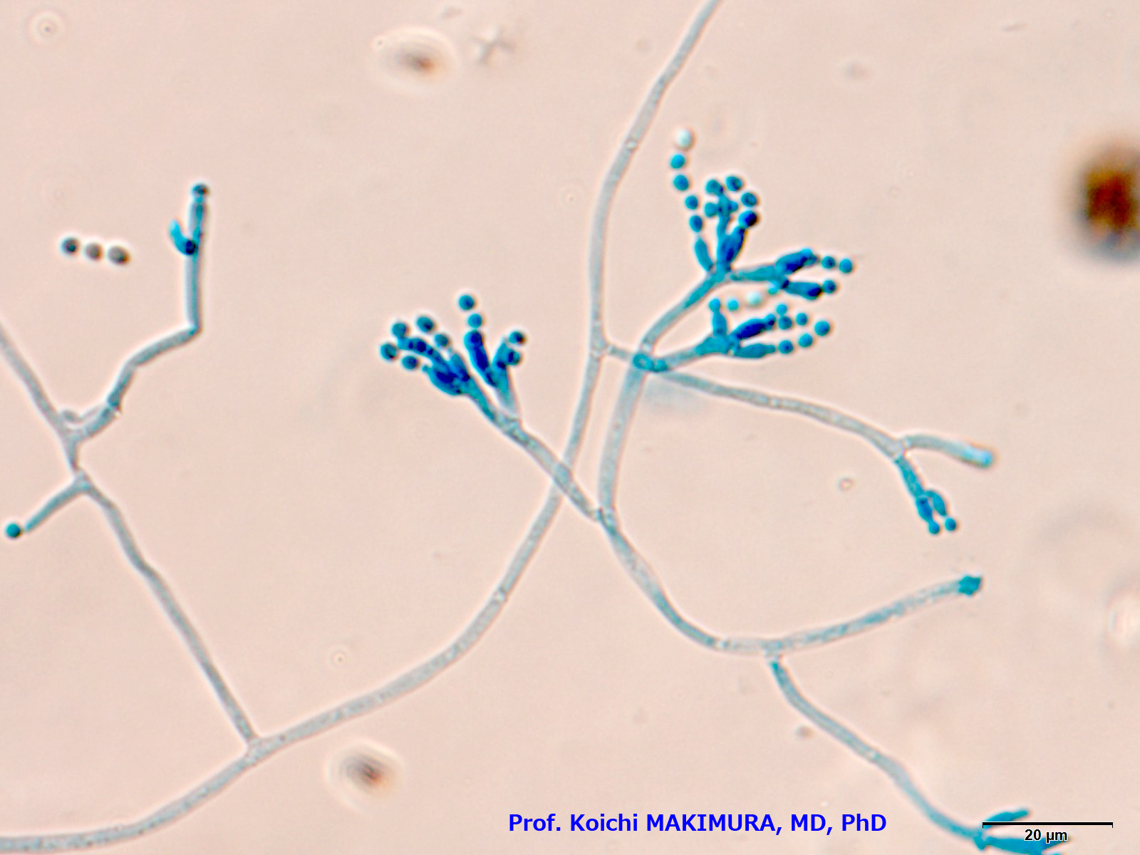 槇村 浩一 Prof Koichi Makimura Md Phd ペニシリウム カメンベルチのラクトフェノールコットンブルー染色テープ標本400倍像 菌糸の幅は広く 分生子は真ん丸で大きいので一寸異様 白カビサラミの 白カビは 長らくp カンジズム Candidumはラテン語で