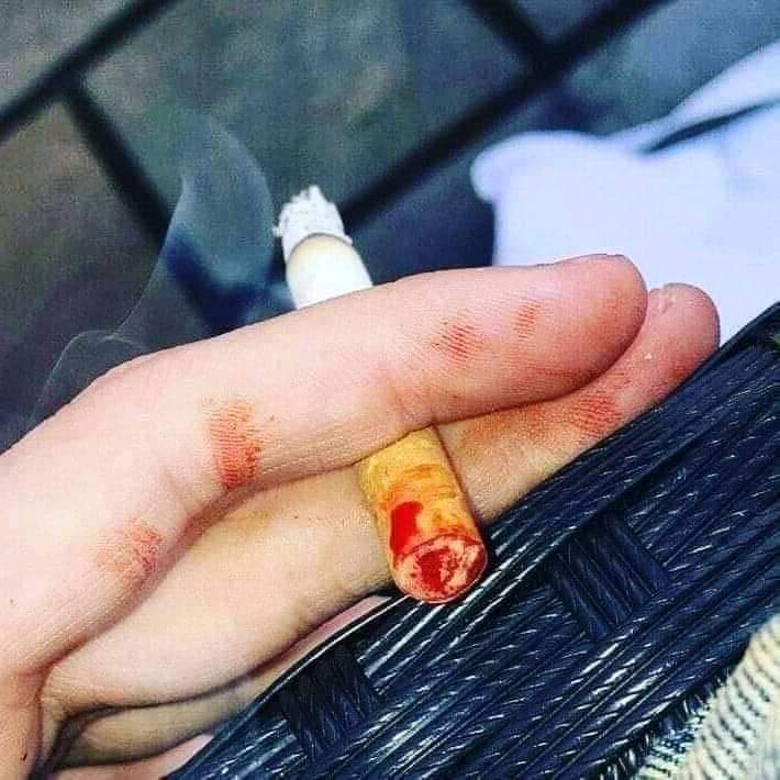 SayedAdnanAbbas's tweet photo. ..اسے کہنا مر نہیں گیا میں__💔🙂
ہاں بس منہ سے خون آتا ہے__🌚
#Danu https://t.co/pygkpeAEMe