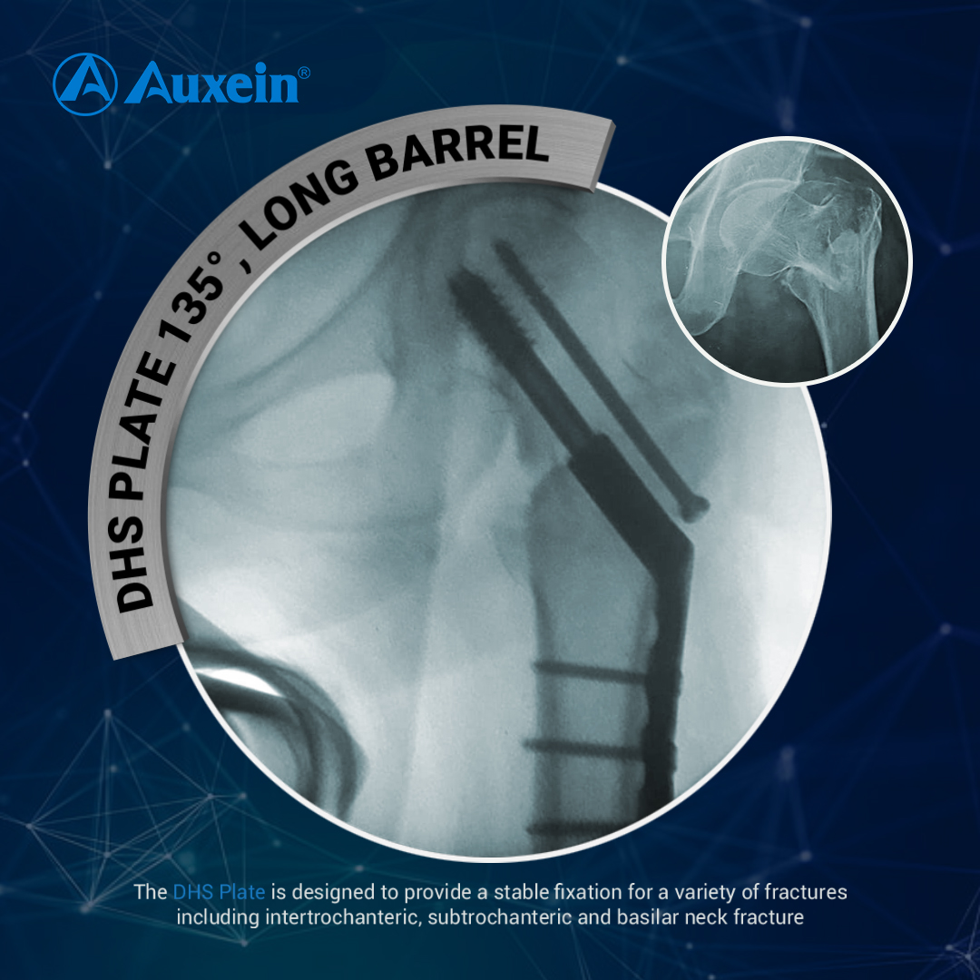 AuxeinMedical's tweet photo. The DHS plate is designed to provide a stable fixation for a variety of fractures including intertrochanteric, subtrochanteric and basilar neck fracture.
Read more - https://t.co/3xQ5RljMg5
#AuxeinMedical #Orthopaedic #SurgicalImplants #Implants #DHSPlate #Surgical #Doctors https://t.co/43CWISo85U