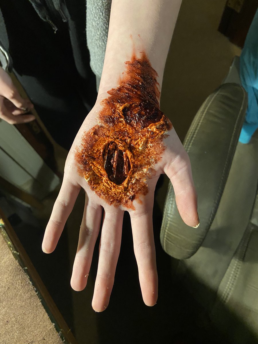 LittleJohn_RC's tweet photo. WARNING GRAPHIC PICTURE โ ๏ธ ๐๐๐ My Daughter just came down and made me jump. She likes to practice making fake wounds. #WhatMyDaughterGetsUptoDuringLockdown #FakeWounds ๐คข๐คฎ https://t.co/TJwxriP9q6