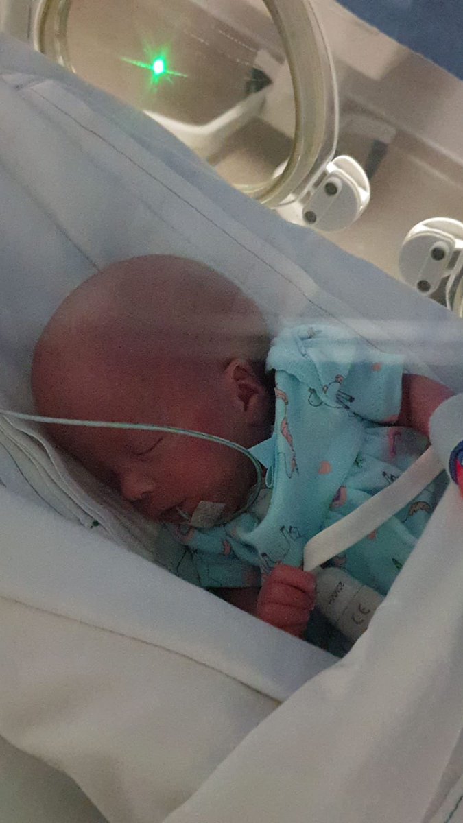 BrendaDonohue's tweet image. This is Roisin born at 29 weeks @_TheNMH weighing less than 1lb.She has been getting donor Breast milk + is now 4lbs! @RTECountryWide @RTERadio1 8am I follow the milk supply chain and see if #Brexit has effected it. I chat to @LouiseLennox_ #bloodbikers + Roisin’s mum #fullcircle