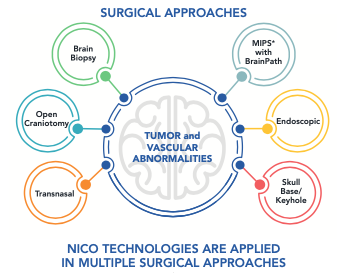NICONeuroCorp's tweet image. NICO knows no neurosurgery procedure or patient is the same. Our technologies can be used in multiple surgical approaches #niconeurosurgery #neurosolutions #neurosurgery niconeuro.com/our-surgical-f…