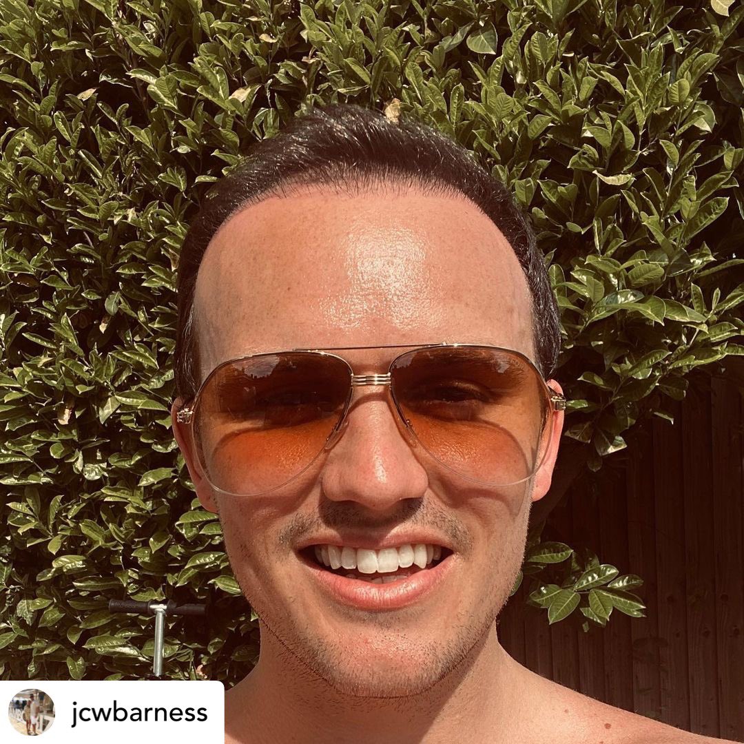 KSL_Clinics's tweet photo. 🔁 REPOST • 12 months progress @ksl_clinics ..
Timed well with lockdown 👨🦲
Thank you Joe for sharing these pictures of your hair transplant journey!
#KSLClinic #HairTransplant #DrMatee #HairTransplantResults #HairJourney #HairLoss #HairRestoration #FUE https://t.co/0Dh0uEazSS