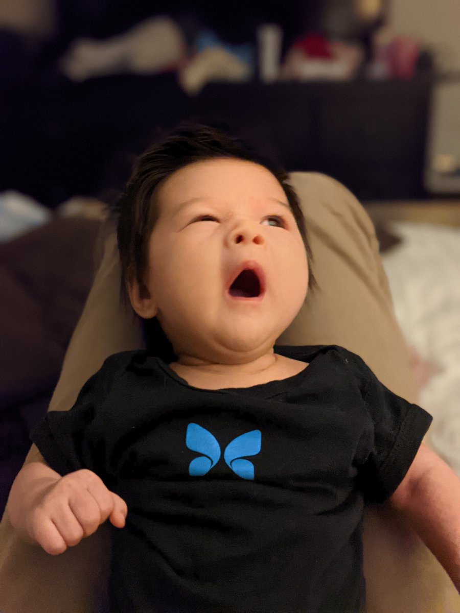 jaffa_md's tweet photo. Inspired by this recent tweet from @JMRothberg to reveal the latest member of the @ButterflyNetInc family 🙃 #POCUS #POCKUS #Cheeks4Weeks @jaffa_im https://t.co/YReW321xOB