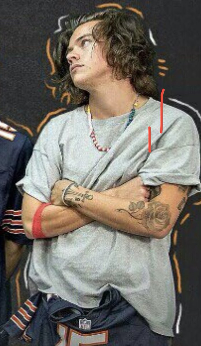 he was also wearing a red bandage on his arm in promo pictures for the north american otra shows, setting up that he’s a regular blood donor. im not sure when or where these were taken but the point still stands lol