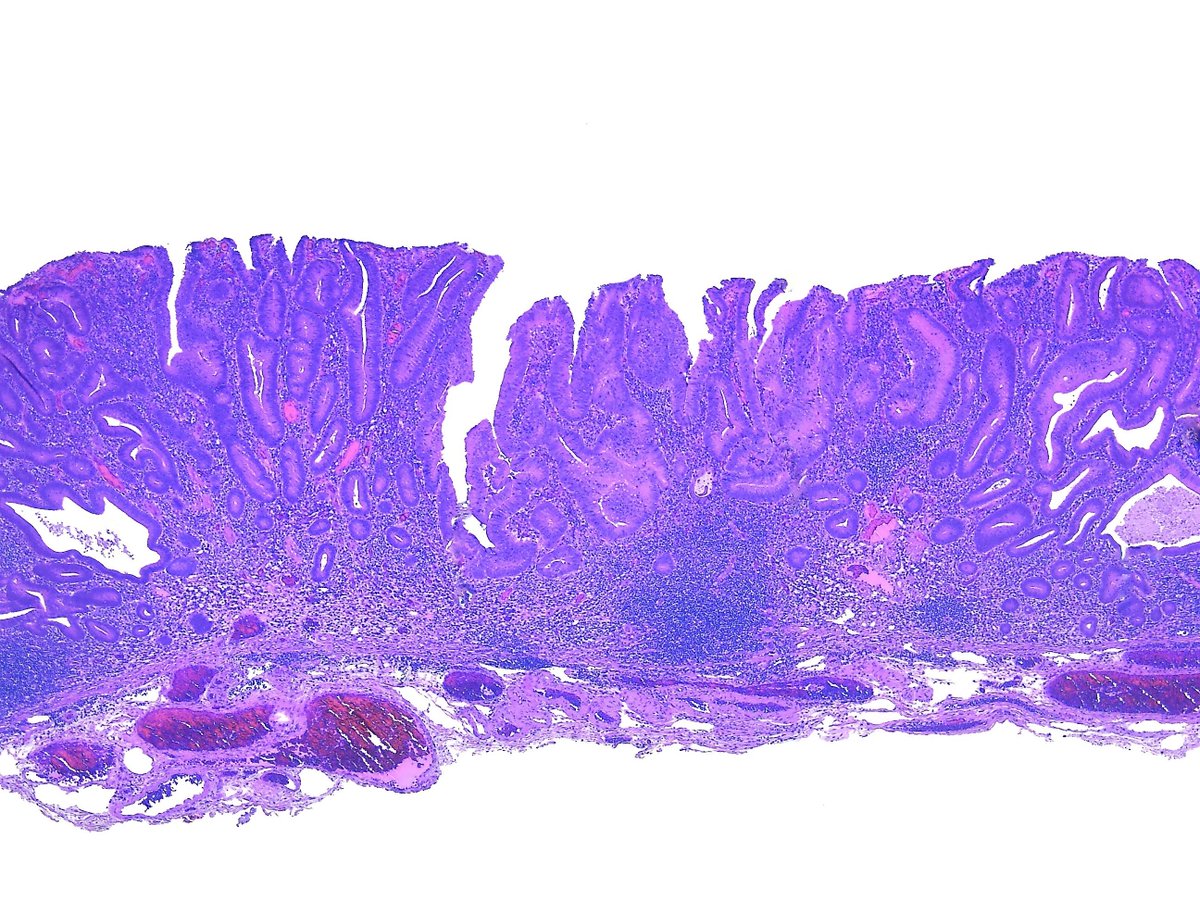 Pathology Walkerauto Tweet Bot On Twitter Stereomicroscopic