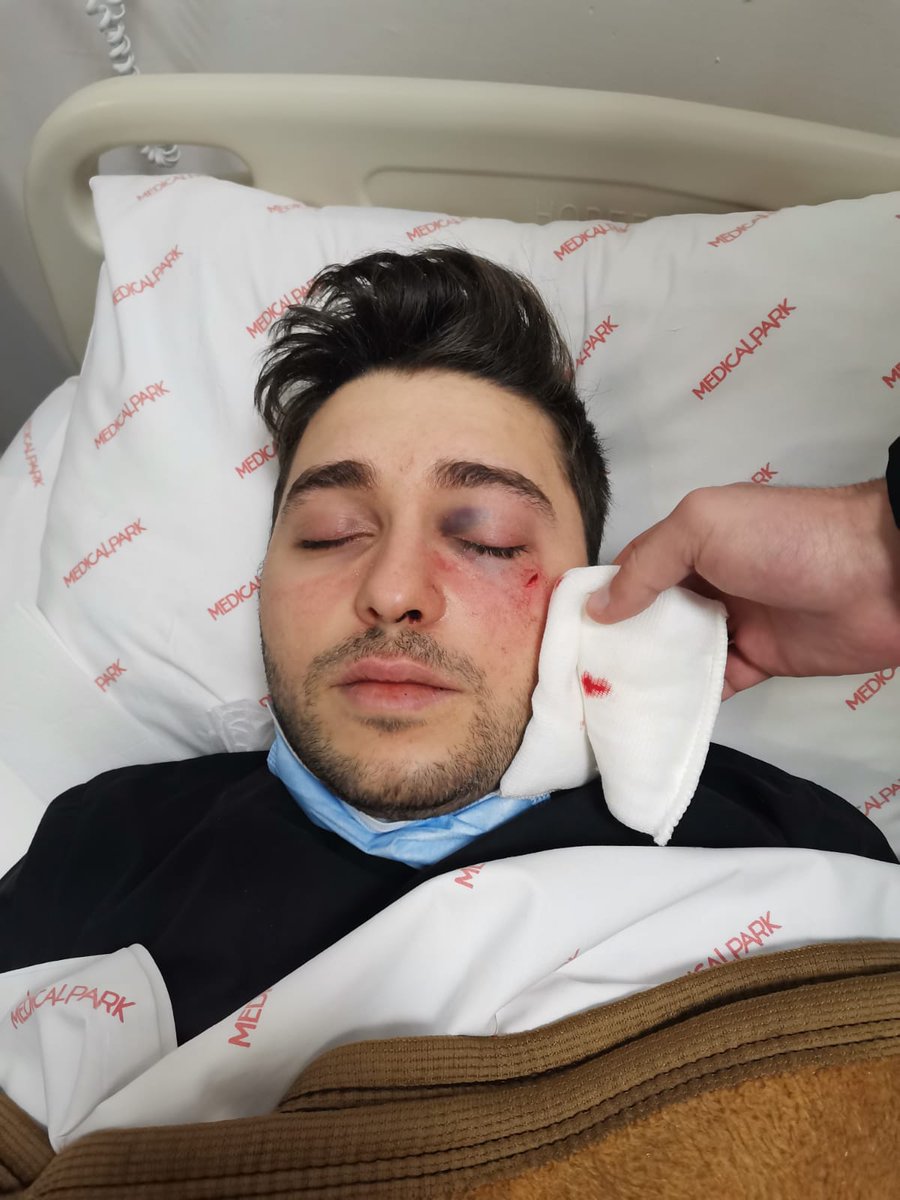 dyguerdal's tweet photo. Cizre Devlet Hastanesinde görevli meslektaşımız, 3 hasta yakını tarafından darp edildi!
İstanbul'da özel bir hastanede görevli meslektaşımız hasta yakınlarını uyardığı için darp edildi!
Peki çözüm nedir?
@RTErdogan
@drfahrettinkoca
#ŞiddetVarsaSağlıkçıYok https://t.co/pXc8aRwKkr