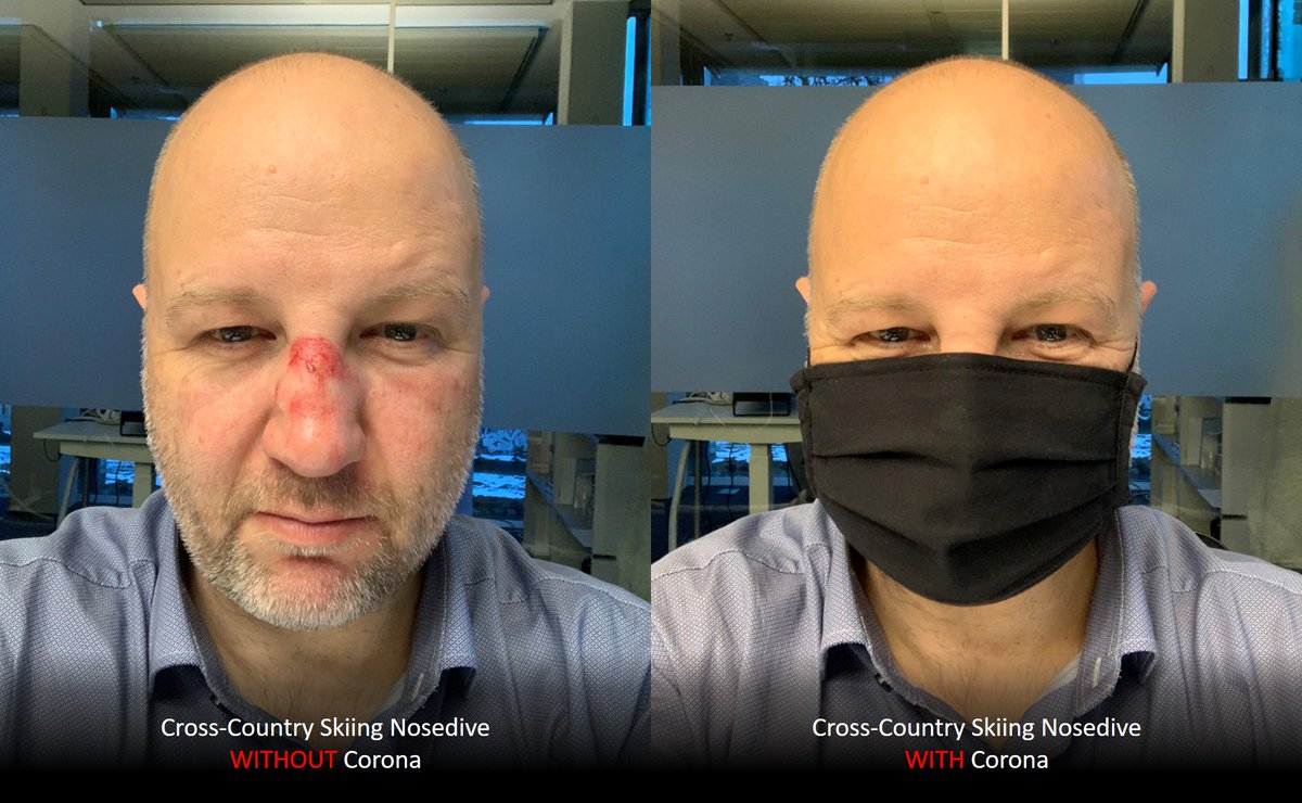 Nach meiner Albatross-Landung im Skilanglauf kann ich dem öffentlichen Maskentragen auch positive Seiten abgewinnen 😷. #SaveTheBirds