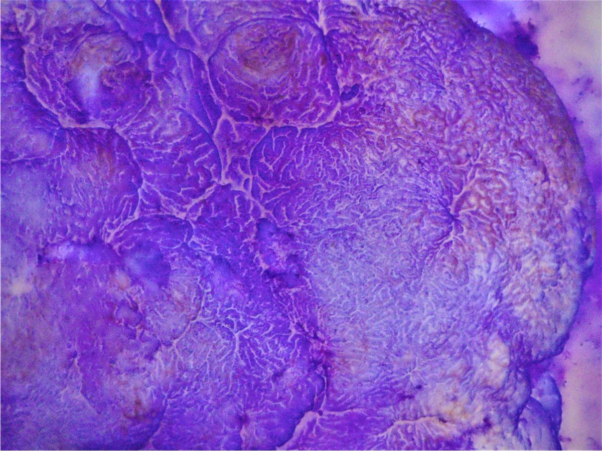 Pathology WalkerAuto Tweet Bot on Twitter "Stereomicroscopic