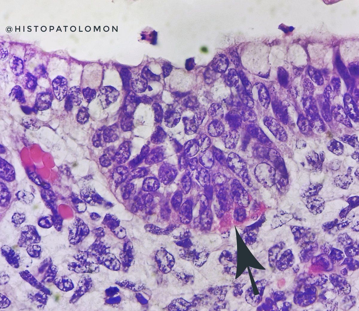 Neuroendocrine cells also appear at 7 weeks. Here we see them with their granules, next to the basement membrane.