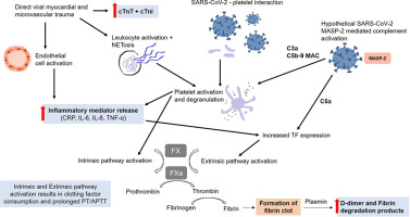 Mechanisms of thrombosis and cardiovascular complications in COVID-19 sciencedirect.com/science/articl…