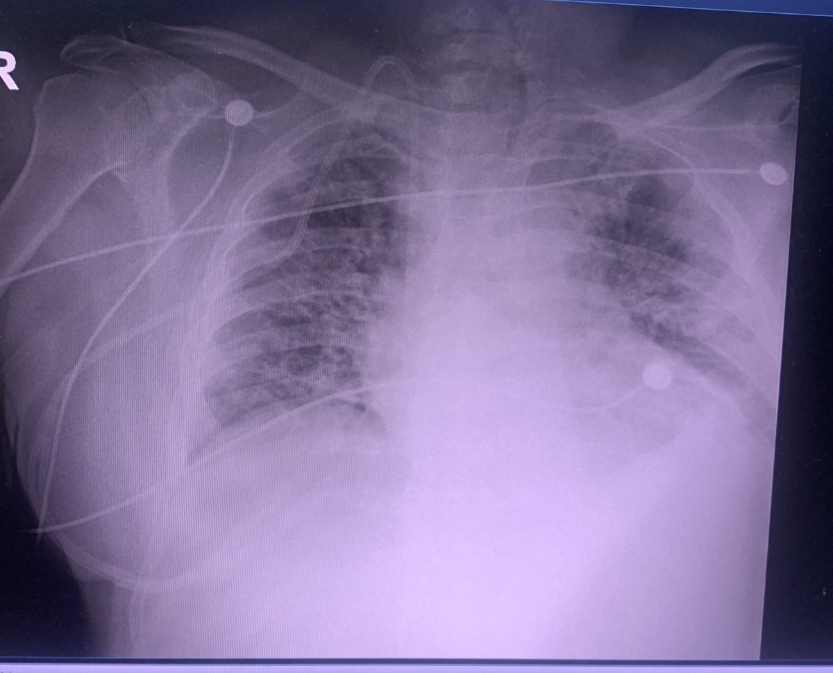 AsierbengoCa's tweet photo. Otro sábado en la oficina y parece que la cosa sigue parecida....  #AUTOCONFINATE ⁦@SEMES_⁩ ⁦⁦@juliomayol⁩ ⁦@ccarballo50⁩ ⁦@_InakiLopez_⁩ ⁦@SeparRespira⁩ ⁦@EzamoraGarc⁩ @ https://t.co/kMyyhf57mS