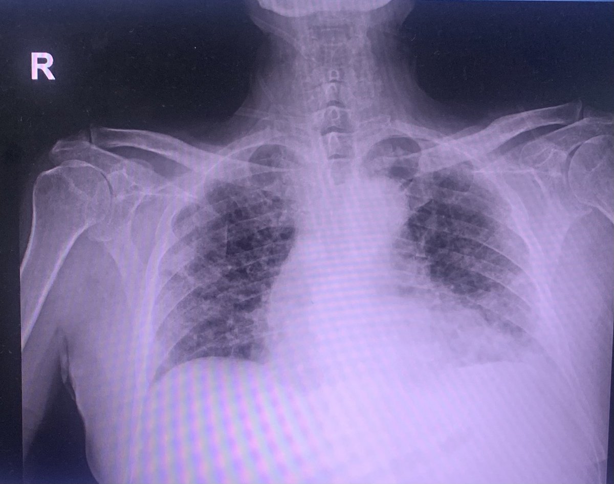 AsierbengoCa's tweet photo. Otro sábado en la oficina y parece que la cosa sigue parecida....  #AUTOCONFINATE ⁦@SEMES_⁩ ⁦⁦@juliomayol⁩ ⁦@ccarballo50⁩ ⁦@_InakiLopez_⁩ ⁦@SeparRespira⁩ ⁦@EzamoraGarc⁩ @ https://t.co/kMyyhf57mS
